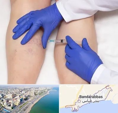 اسکلروتراپی در بندرعباس