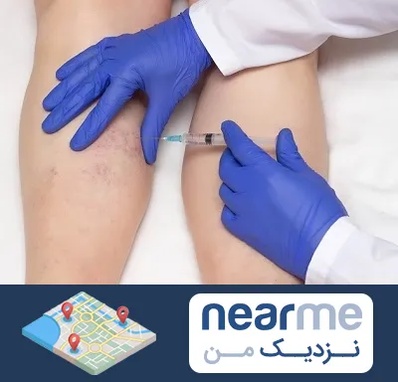 اسکلروتراپی در نزدیک من