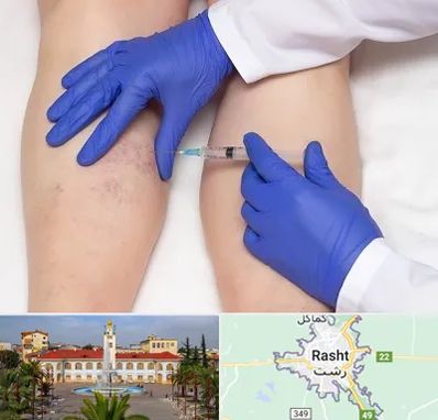 اسکلروتراپی در رشت
