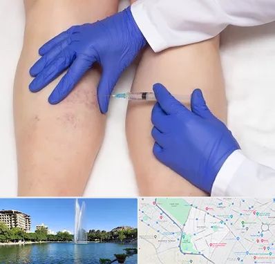 اسکلروتراپی در کوهسنگی مشهد