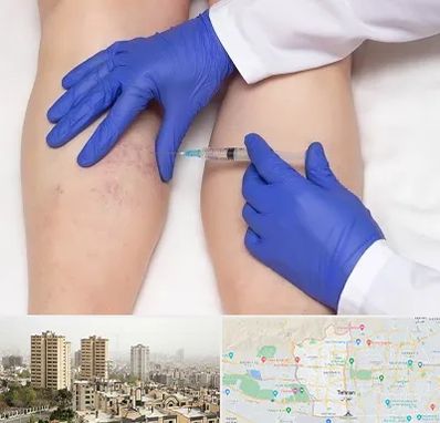 اسکلروتراپی در منطقه 5 تهران 