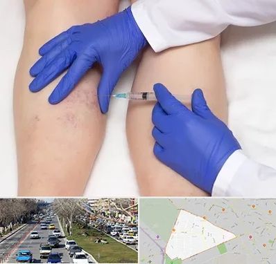 اسکلروتراپی در احمدآباد مشهد 