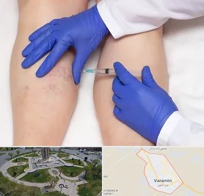 اسکلروتراپی در ورامین