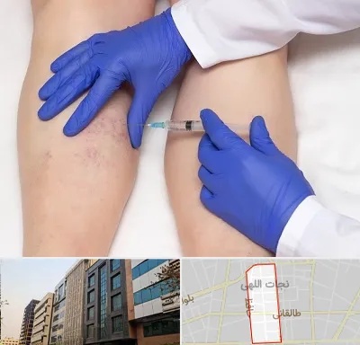 اسکلروتراپی در نجات اللهی