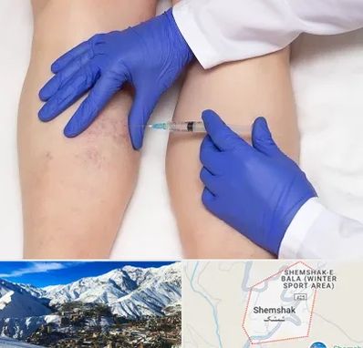 اسکلروتراپی در شمشک