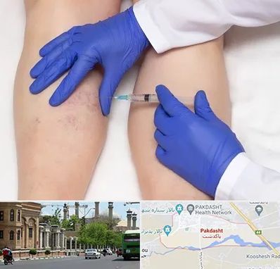 اسکلروتراپی در پاکدشت