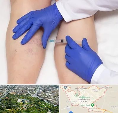 اسکلروتراپی در شهرکرد