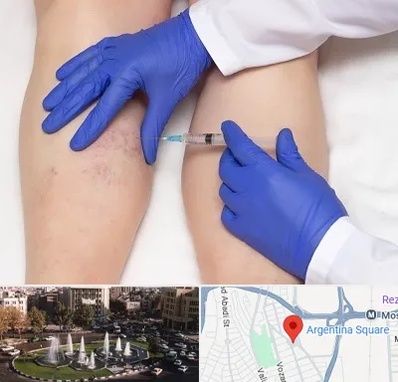 اسکلروتراپی در آرژانتین
