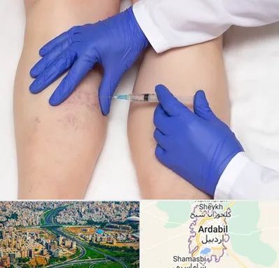اسکلروتراپی در اردبیل