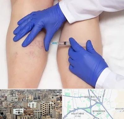 اسکلروتراپی در جنوب شرق تهران