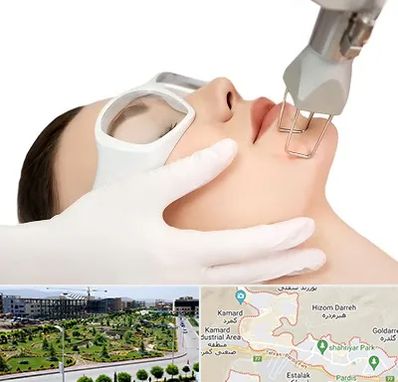 لیزر فرکشنال در پردیس