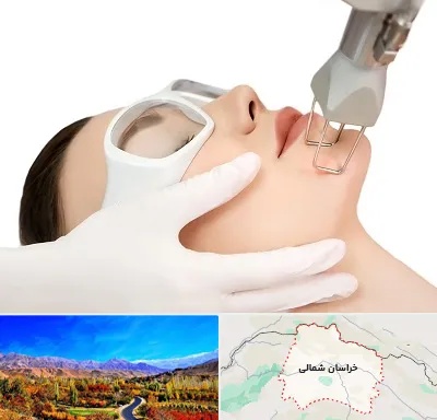 لیزر فرکشنال در خراسان شمالی