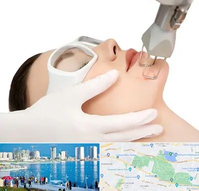 لیزر فرکشنال در چیتگر 