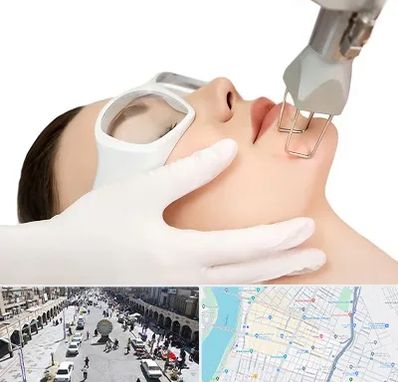 لیزر فرکشنال در نادری اهواز