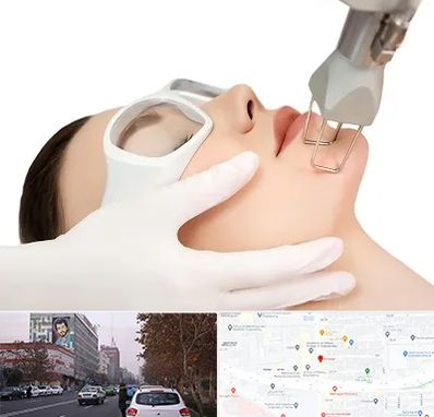 لیزر فرکشنال در کارگر شمالی 