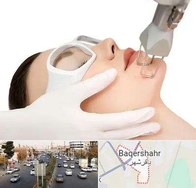 لیزر فرکشنال در باقرشهر