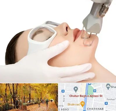 لیزر فرکشنال در چهارباغ اصفهان