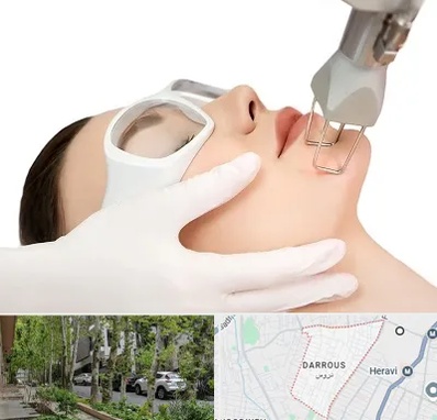 لیزر فرکشنال در دروس