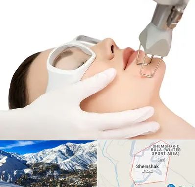 لیزر فرکشنال در شمشک