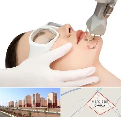 لیزر فرکشنال در پردیسان قم
