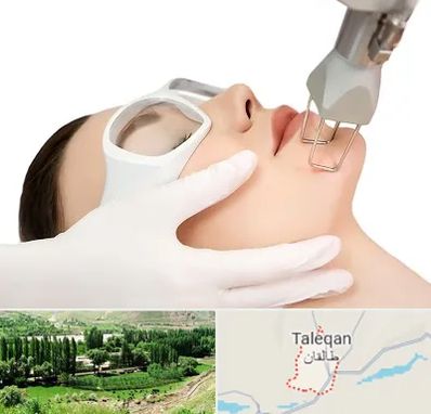 لیزر فرکشنال در طالقان