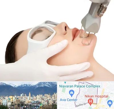 لیزر فرکشنال در آجودانیه 