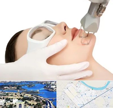 لیزر فرکشنال در کوروش اهواز