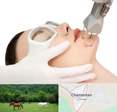 لیزر فرکشنال در چمستان