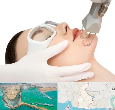 لیزر فرکشنال در سیستان و بلوچستان