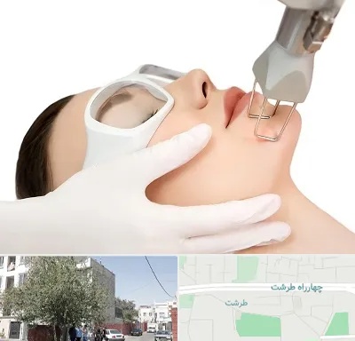 لیزر فرکشنال در طرشت
