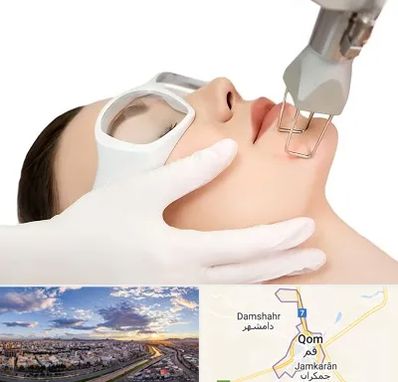 لیزر فرکشنال در قم