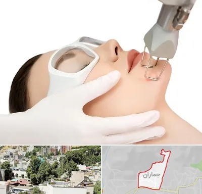 لیزر فرکشنال در جماران