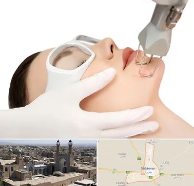 لیزر فرکشنال در سبزوار