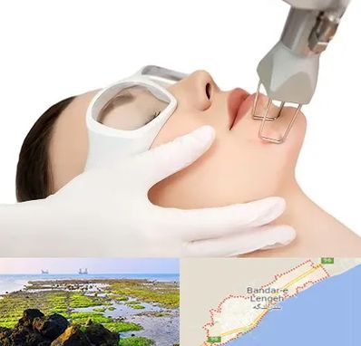 لیزر فرکشنال در بندرلنگه