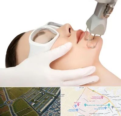 لیزر فرکشنال در الهیه مشهد