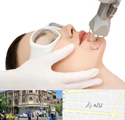 لیزر فرکشنال در لاله زار