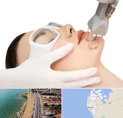 لیزر فرکشنال در بوشهر