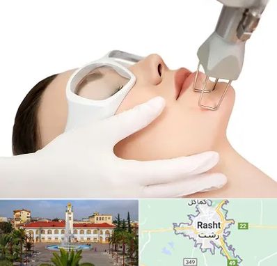 لیزر فرکشنال در رشت