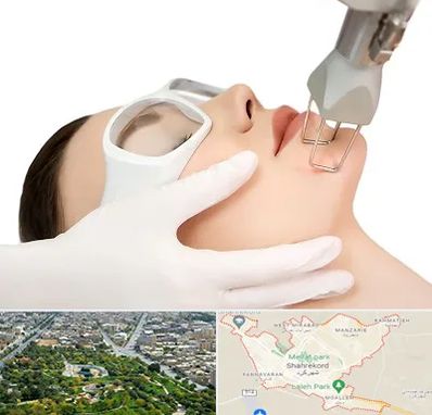 لیزر فرکشنال در شهرکرد