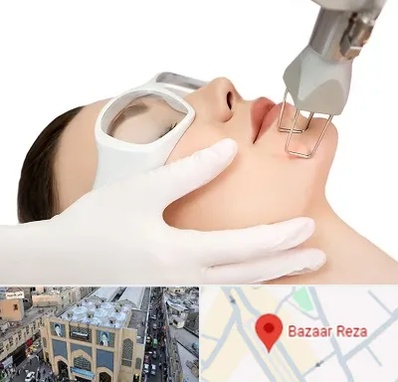 لیزر فرکشنال در بازار رضا مشهد