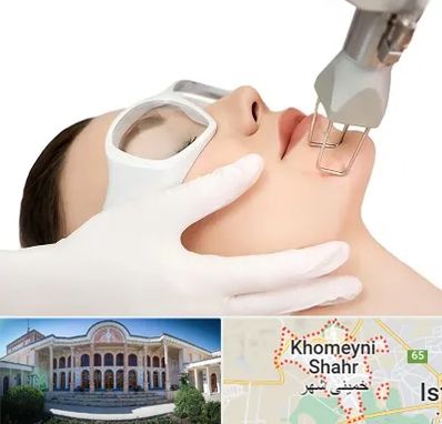 لیزر فرکشنال در خمینی شهر