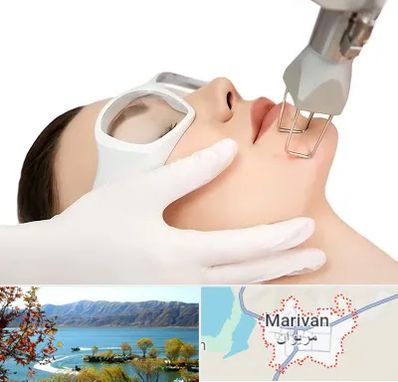 لیزر فرکشنال در مریوان