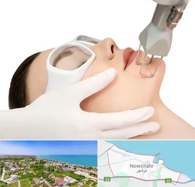 لیزر فرکشنال در نوشهر