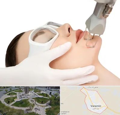 لیزر فرکشنال در ورامین