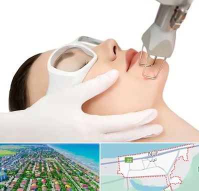 لیزر فرکشنال در نور