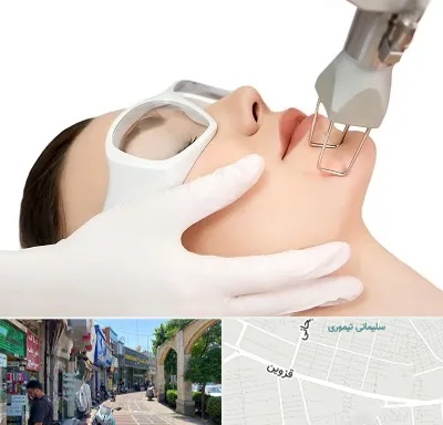لیزر فرکشنال در خیابان قزوین