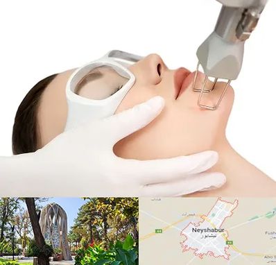 لیزر فرکشنال در نیشابور