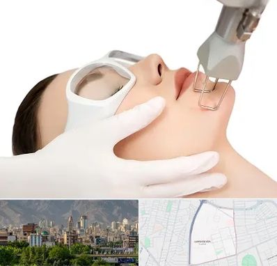 لیزر فرکشنال در جمشیدیه