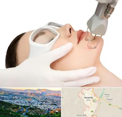 لیزر فرکشنال در سنندج