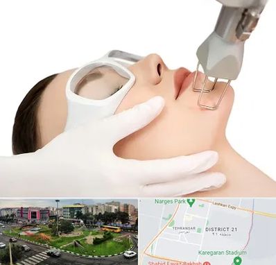 لیزر فرکشنال در تهرانسر 